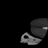 SPORK, NICO - 22.03.1976 - 02.08.2022 - CT obere Extremität - 17:51:17